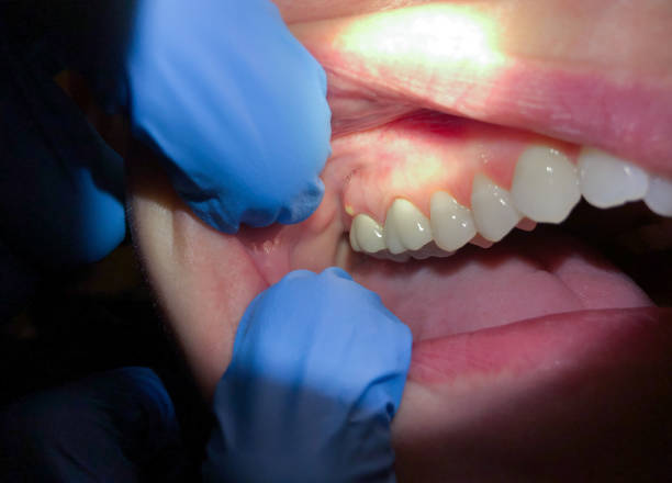 Best Emergency Dentist for Special Needs Patients in Hartsville, SC